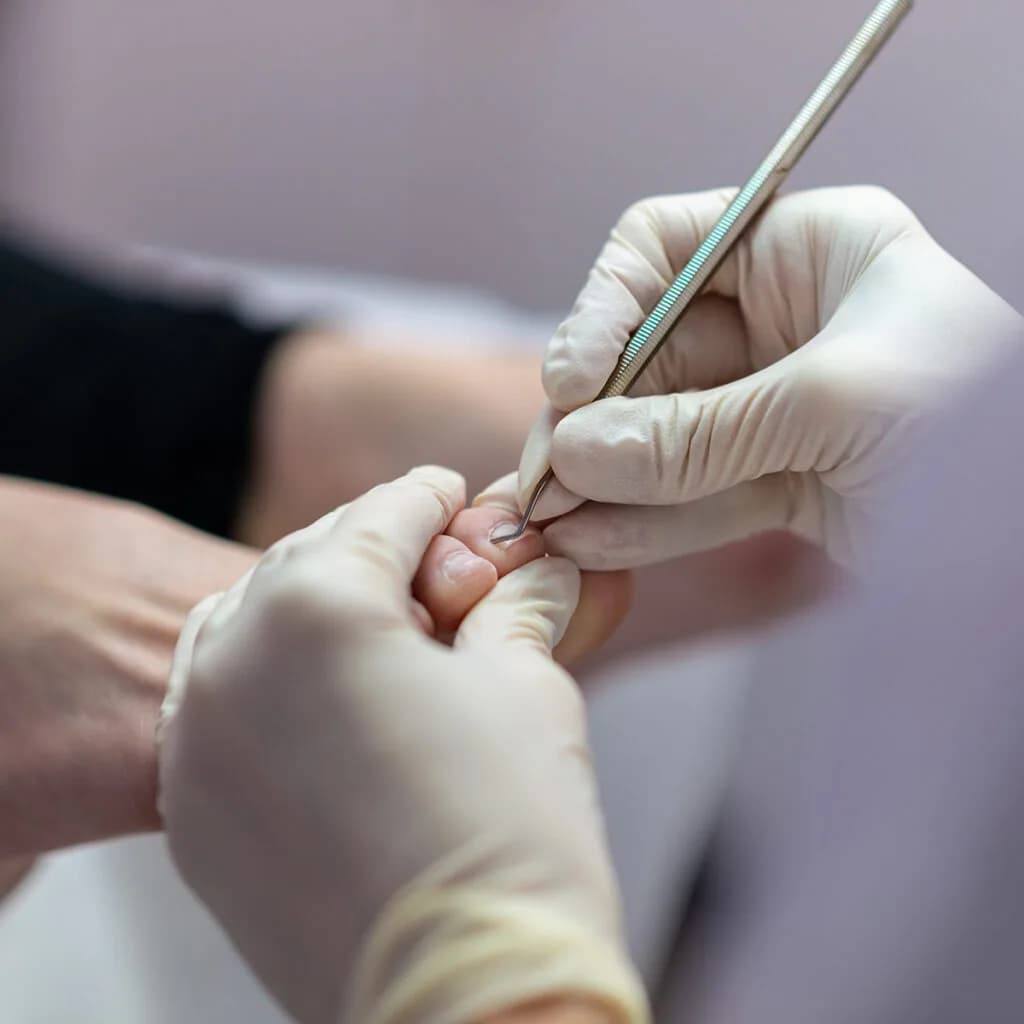 Behandlung Diabetes-Fuß